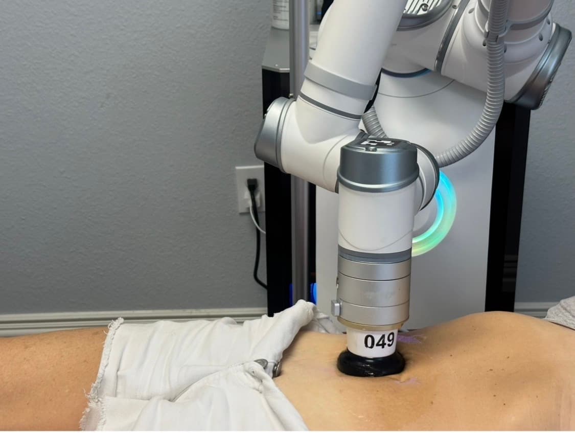 An RF applicator on a robotic arm resting on a client's stomach during an RF body treatment at Strrretch Frisco