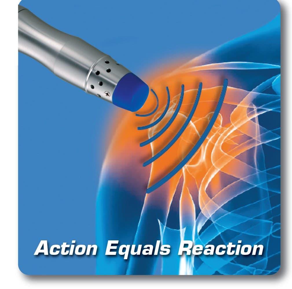 Illustration of a Shockwave applicator directing focused acoustic waves toward the shoulder